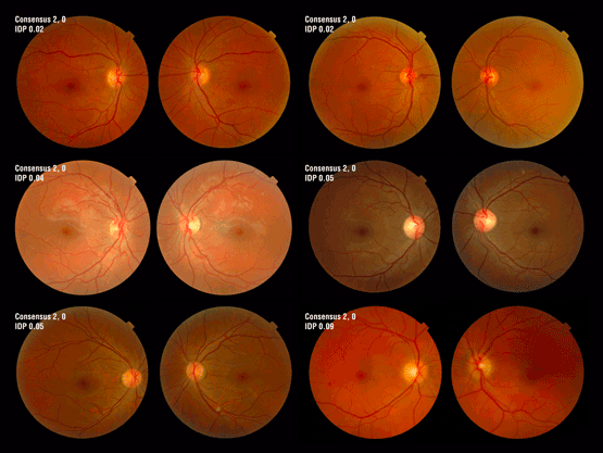 Digital Retinal Imaging