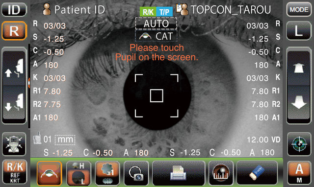 Corneal Pachymeter