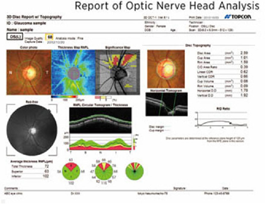 Vue Vision Centre | Advanced Technology