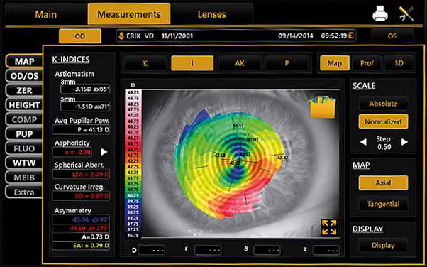 Corneal Topographer