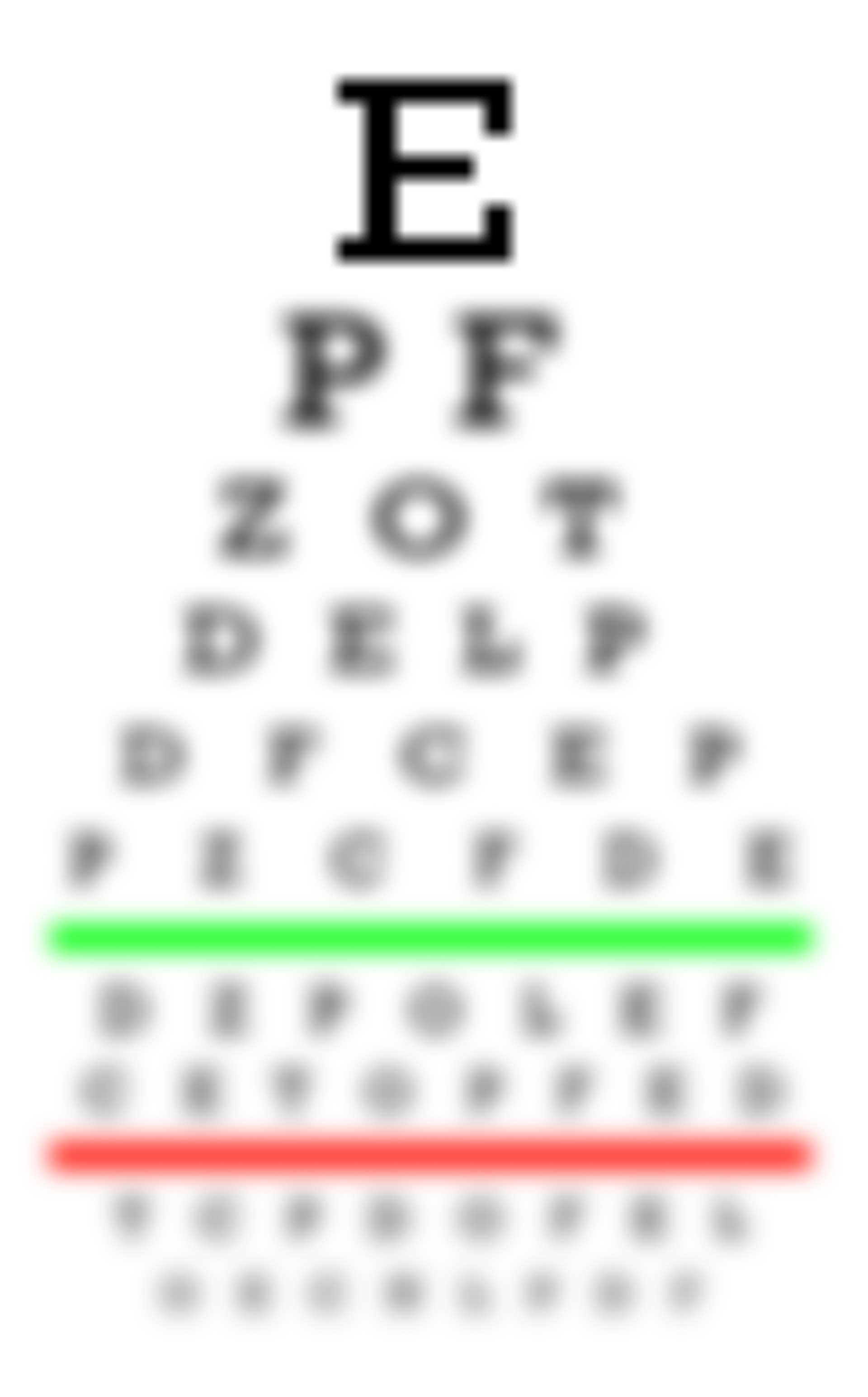 myopia diagnózis
