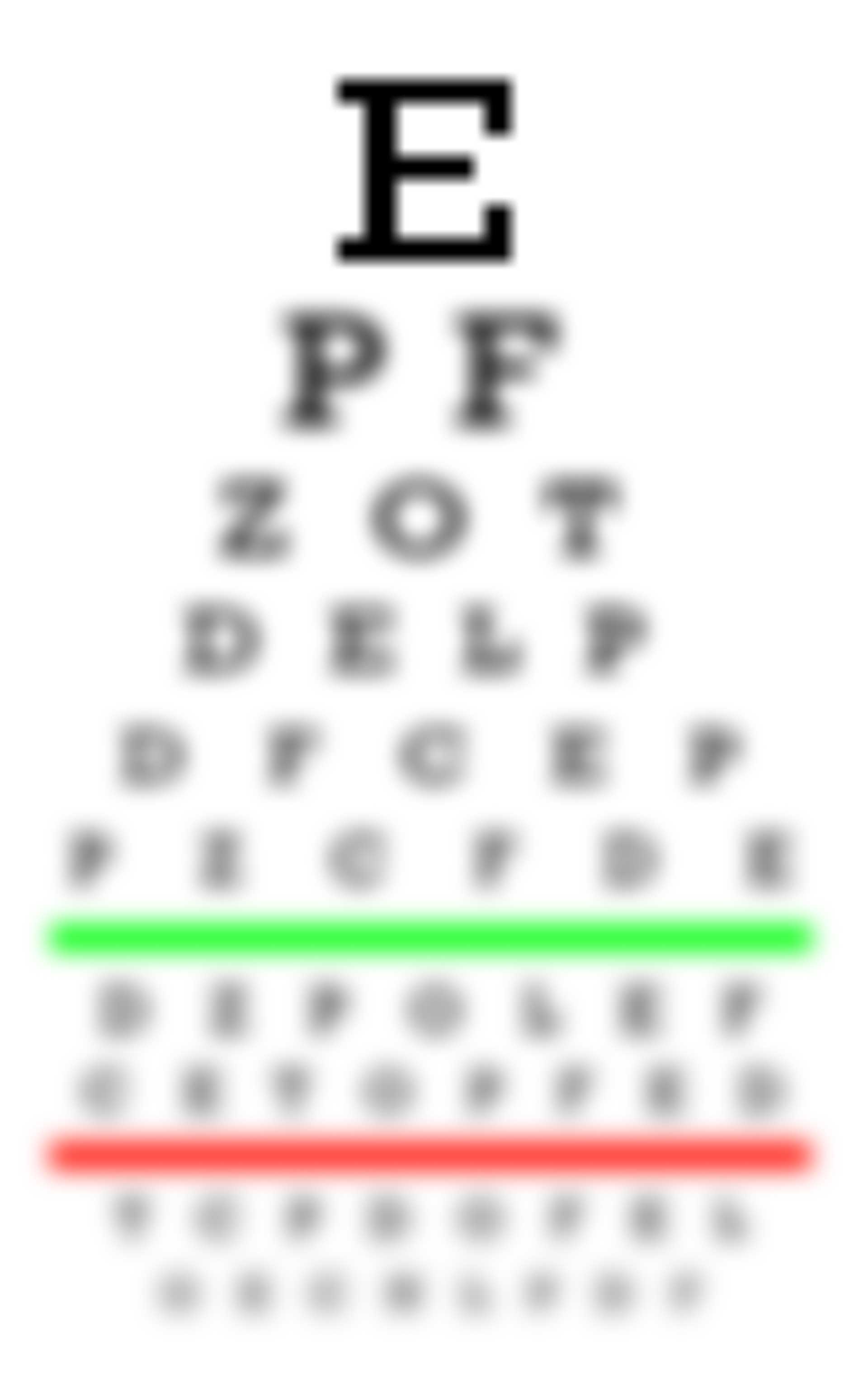 Myopia and Hypermetropia: Symptoms & Treatment - Vue Vision